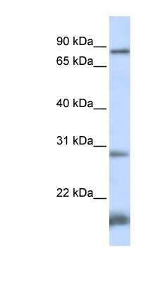 Western Blot: SMYD4 Antibody [NBP1-79406] - 721_B cell lysate, concentration 0.2-1 ug/ml.
