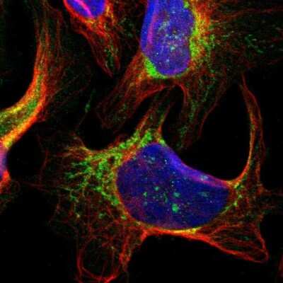 Immunocytochemistry/ Immunofluorescence SMYD5 Antibody - BSA Free