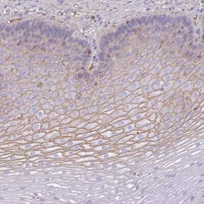 Immunohistochemistry-Paraffin: SMYD5 Antibody [NBP2-38598] - Staining of human esophagus shows moderate membranous positivity in squamous epithelial cells.