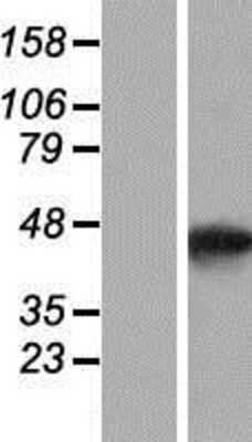 Western Blot: SMYD5 Overexpression Lysate (Adult Normal) [NBP2-07674] Left-Empty vector transfected control cell lysate (HEK293 cell lysate); Right -Over-expression Lysate for SMYD5.