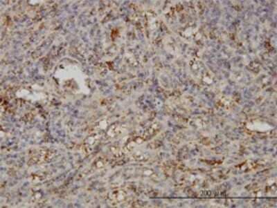 Immunohistochemistry-Paraffin: SNAP23 Antibody (2F5-3D4) [H00008773-M01] - Analysis of monoclonal antibody to SNAP23 on formalin-fixed paraffin-embedded human spleen. Antibody concentration 3 ug/ml.