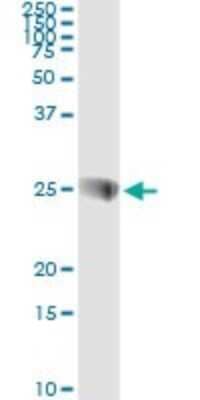 Immunoprecipitation: SNAP23 Antibody (2F5-3D4) [H00008773-M01] - Analysis of SNAP23 transfected lysate using anti-SNAP23 monoclonal antibody and Protein A Magnetic Bead, and immunoblotted with SNAP23 MaxPab rabbit polyclonal antibody.