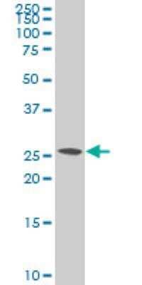 Western Blot: SNAP23 Antibody (2F5-3D4) [H00008773-M01] - SNAP23 expression in Raw 264.7.