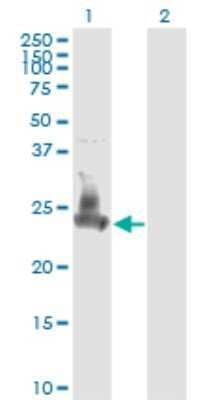 Western Blot: SNAP23 Antibody (2F5-3D4) [H00008773-M01] - Analysis of SNAP23 expression in transfected 293T cell line by SNAP23 monoclonal antibody (M01), clone 2F5-3D4.Lane 1: SNAP23 transfected lysate (Predicted MW: 23.4 KDa).Lane 2: Non-transfected lysate.