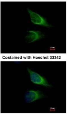 Immunocytochemistry/Immunofluorescence: SNAP23 Antibody [NBP1-32694] - Analysis of methanol-fixed HeLa, using antibody at 1:500 dilution.