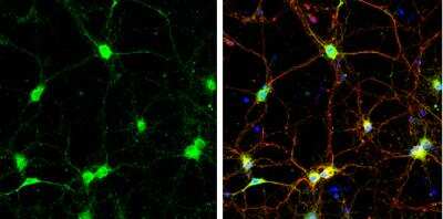 Immunocytochemistry/Immunofluorescence: SNAP23 Antibody [NBP1-32694] - DIV9 rat E18 primary cortical neurons were fixed in 4% paraformaldehyde at RT for 15 min. Green: SNAP23 protein stained by SNAP23 antibody diluted at 1:500.Red: beta Tubulin 3/ Tuj1, a neuron cell marker, stained by beta Tubulin 3/ Tuj1 antibody [11710] diluted at 1:500. Blue: Fluoroshield with DAPI. 