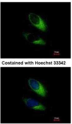 Immunocytochemistry/Immunofluorescence: SNAP23 Antibody [NBP2-20434] - Analysis of methanol-fixed HeLa, using antibody at 1:500 dilution.