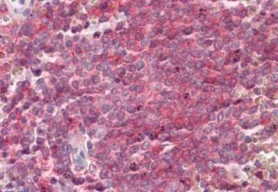 Immunohistochemistry-Paraffin: SNAP23 Antibody [NBP1-49855] - 3.75ug/ml staining of paraffin embedded Human Spleen. Steamed antigen retrieval with citrate buffer pH 6, AP-staining.