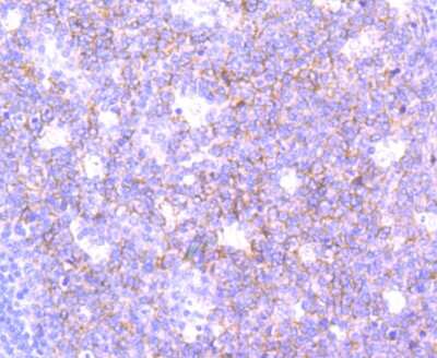 Immunohistochemistry-Paraffin: SNAP23 Antibody (JA73-15) [NBP2-67157] - Analysis of paraffin-embedded human tonsil tissue using anti-SNAP23 antibody. Counter stained with hematoxylin.