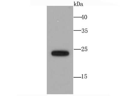 Western Blot: SNAP23 Antibody (JA73-15) [NBP2-67157] - Analysis of SNAP23 on Hela cell using anti-SNAP23 antibody at 1/1,000 dilution.