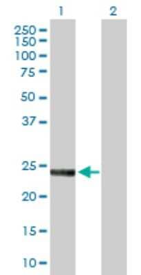 Western Blot: SNAP23 Antibody [H00008773-D01P] - Analysis of SNAP23 expression in transfected 293T cell line by SNAP23 polyclonal antibody.Lane 1: SNAP23 transfected lysate(23.40 KDa).Lane 2: Non-transfected lysate.