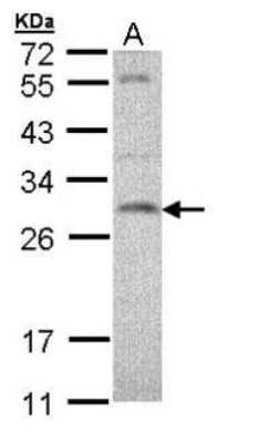 Western Blot: SNAP23 Antibody [NBP1-32694] - (30 ug of whole cell lysate) A: H1299 12% SDS PAGE diluted at 1:1000