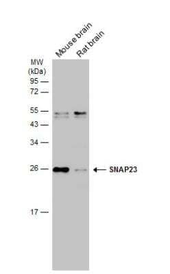 Western Blot: SNAP23 Antibody [NBP1-32694] - Various tissue extracts (50 ug) were separated by 12% SDS-PAGE, and the membrane was blotted with SNAP23 antibody diluted at 1:1000. The HRP-conjugated anti-rabbit IgG antibody (NBP2-19301) was used to detect the primary antibody.