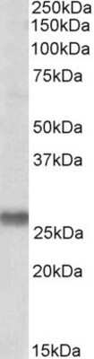 Western Blot: SNAP23 Antibody [NBP1-49855] - Analysis of SNAP23 in Human Placenta lysate (35ug protein in RIPA buffer) using this antibody at 0.1 ug/ml. Primary incubation was 1 hour. Detected by chemiluminescence.