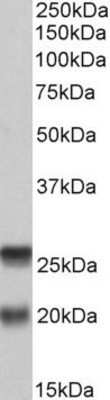 Western Blot: SNAP23 Antibody [NBP1-52065] - (0.2ug/ml) Analysis of PBMC lysate (35ug protein in RIPA buffer). Primary incubation was 1 hour. Detected by chemiluminescence.