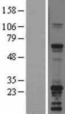 Western Blot: SNAP23 Overexpression Lysate (Adult Normal) [NBL1-16267] Left-Empty vector transfected control cell lysate (HEK293 cell lysate); Right -Over-expression Lysate for SNAP23.