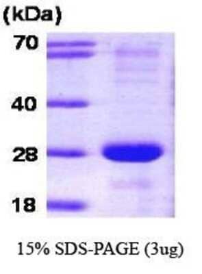 SDS-Page: Recombinant Human SNAP23 Protein [NBC1-18347] - SNAP23, 23.3 kDa (211 aa) , confirmed by MALDI-TOF with a purity of 90% by SDS - PAGE