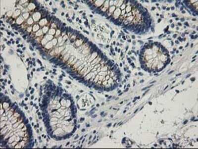 Immunohistochemistry: SNAP25 Antibody (OTI4G5) - Azide and BSA Free [NBP2-74245] - Staining of paraffin-embedded Human colon tissue using anti-SNAP25 mouse monoclonal antibody.