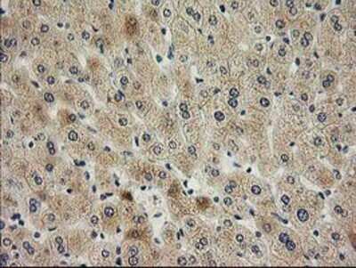 Immunohistochemistry: SNAP25 Antibody (OTI4G5) - Azide and BSA Free [NBP2-74245] - Staining of paraffin-embedded Human liver tissue using anti-SNAP25 mouse monoclonal antibody.