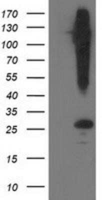 Western Blot: SNAP25 Antibody (OTI4G5) - Azide and BSA Free [NBP2-74245] - HEK293T cells were transfected with the pCMV6-ENTRY control (Left lane) or pCMV6-ENTRY SNAP25 (Right lane) cDNA for 48 hrs and lysed. Equivalent amounts of cell lysates (5 ug per lane) were separated by SDS-PAGE and immunoblotted with anti-SNAP25.