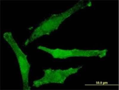 Immunocytochemistry/Immunofluorescence: SNAP29 Antibody (3E4-E6) [H00009342-M01] - Analysis of monoclonal antibody to SNAP29 on HeLa cell . Antibody concentration 10 ug/ml.