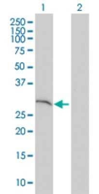 Western Blot: SNAP29 Antibody (3E4-E6) [H00009342-M01] - Analysis of SNAP29 expression in transfected 293T cell line by SNAP29 monoclonal antibody (M01), clone 3E4-E6.Lane 1: SNAP29 transfected lysate(28.38 KDa).Lane 2: Non-transfected lysate.