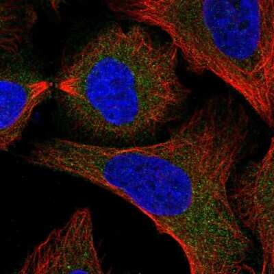Immunocytochemistry/Immunofluorescence: SNAP29 Antibody [NBP2-58573] - Staining of human cell line U-2 OS shows localization to cytosol.