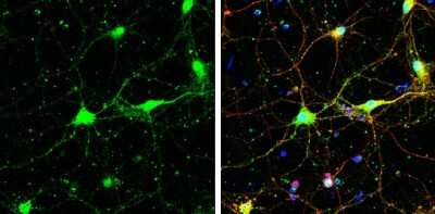 Immunocytochemistry/Immunofluorescence: SNAP29 Antibody [NBP3-12979] - SNAP29 antibody detects SNAP29 protein at cell body and synaptic vesicles by immunofluorescent analysis. Sample: DIV9 rat E18 primary cortical neurons were fixed in 4% paraformaldehyde at RT for 15 min. Green: SNAP29 protein stained by SNAP29 antibody (NBP3-12979) diluted at 1:500. Red: beta Tubulin 3/ Tuj1, a neuron cell marker, stained by beta Tubulin 3/ Tuj1 antibody [GT11710] (NBP2-43559) diluted at 1:500. Blue: Fluoroshield with DAPI.
