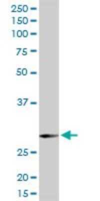 Western Blot: SNAP29 Antibody [H00009342-D01P] - Analysis of SNAP29 expression in rat brain.