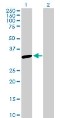Western Blot: SNAP29 Antibody [H00009342-D01P] - Analysis of SNAP29 expression in transfected 293T cell line by SNAP29 polyclonal antibody.Lane 1: SNAP29 transfected lysate(29.00 KDa).Lane 2: Non-transfected lysate.