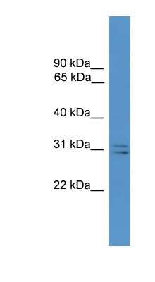 Western Blot: SNAP29 Antibody [NBP1-69180] - Human Brain lysate, concentration 0.2-1 ug/ml.