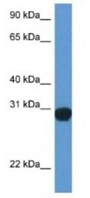 Western Blot: SNAP29 Antibody [NBP1-79769] - Rat Lung Lysate 1ug/ml  Gel Concentration 12%