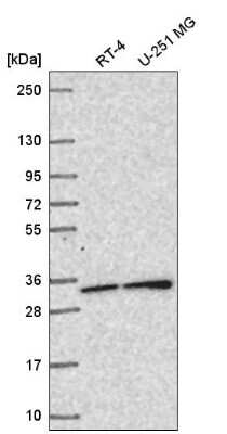 Western Blot: SNAP29 Antibody [NBP2-58573] - Western blot analysis in human cell line RT-4 and human cell line U-251 MG.