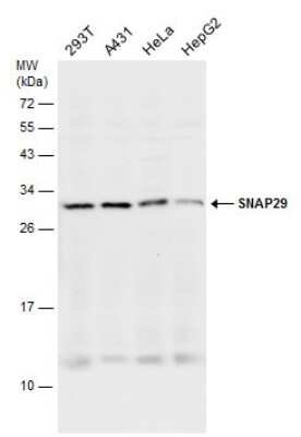 Western Blot: SNAP29 Antibody [NBP3-12979] - Various whole cell extracts (30 ug) were separated by 12% SDS-PAGE, and the membrane was blotted with SNAP29 antibody (NBP3-12979) diluted at 1:1000.