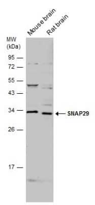 Western Blot: SNAP29 Antibody [NBP3-12979] - Various tissue extracts (50 ug) were separated by 12% SDS-PAGE, and the membrane was blotted with SNAP29 antibody (NBP3-12979) diluted at 1:500.