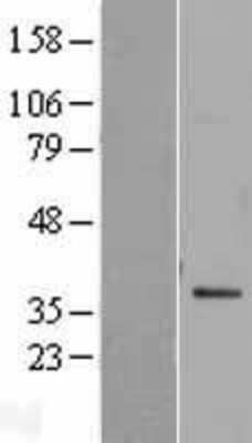 Western Blot: SNAP29 Overexpression Lysate (Adult Normal) [NBP2-04278] Left-Empty vector transfected control cell lysate (HEK293 cell lysate); Right -Over-expression Lysate for SNAP29.