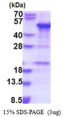 SDS-PAGE Recombinant Human SNAP43 His Protein