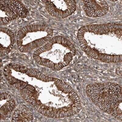 Immunohistochemistry-Paraffin SNAP47 Antibody