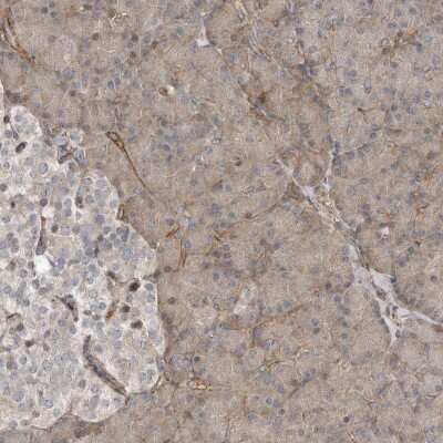 Immunohistochemistry-Paraffin SNAP47 Antibody