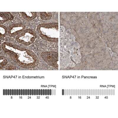 Immunohistochemistry-Paraffin SNAP47 Antibody