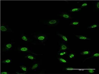 Immunocytochemistry/Immunofluorescence: SNAPC4 Antibody (X1) [H00006621-M09] - Analysis of monoclonal antibody to SNAPC4 on HeLa cell. Antibody concentration 10 ug/ml