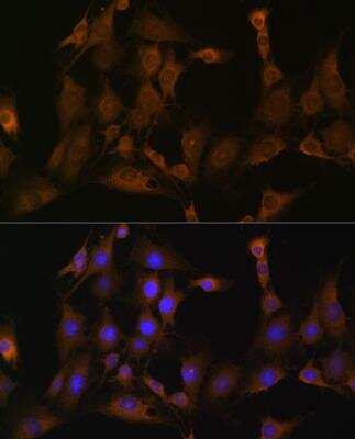 Immunocytochemistry/Immunofluorescence: SND1 Antibody [NBP2-94469] - Analysis of C6 cells using SND1 Rabbit pAb at dilution of 1:100 (40x lens). Blue: DAPI for nuclear staining.