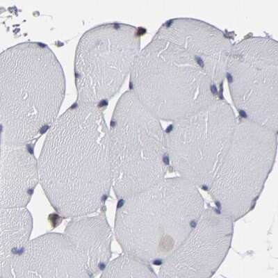 Immunohistochemistry-Paraffin: SND1 Antibody [NBP1-82460] - Staining of human skeletal muscle using Anti-SND1 antibody NBP1-82460.