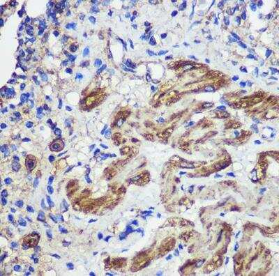 Immunohistochemistry-Paraffin: SND1 Antibody [NBP2-94469] - Rat lung using SND1 Rabbit pAb at dilution of 1:100 (40x lens).