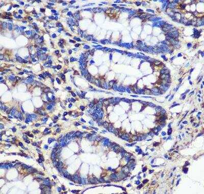 Immunohistochemistry-Paraffin: SND1 Antibody [NBP2-94469] - Human colon using SND1 Rabbit pAb at dilution of 1:100 (40x lens).