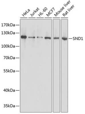 <b>Genetic Strategies Validation. </b>Western Blot: SND1 Antibody [NBP2-94095] - Analysis of extracts of various cell lines, using SND1 at 1:1000 dilution. Secondary antibody: HRP Goat Anti-Rabbit IgG (H+L) at 1:10000 dilution. Lysates/proteins: 25ug per lane. Blocking buffer: 3% nonfat dry milk in TBST. Detection: ECL Basic Kit . Exposure time: 1s.