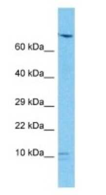 Western Blot: SND1-IT1 Antibody [NBP3-09331] - Western blot analysis of SND1-IT1 in Stomach Tumor lysates. Antibody dilution at 1.0ug/ml