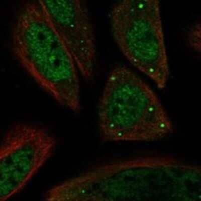 Immunocytochemistry/Immunofluorescence: SNF1LK2/SIK2 Antibody [NBP3-17676] - Staining of human cell line SiHa shows localization to nucleoplasm, nuclear speckles, cytosol & vesicles.