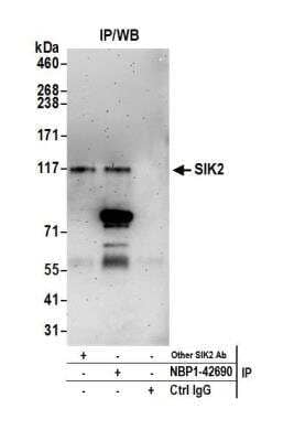 <b>Independent Antibodies Validation. </b>Immunoprecipitation: SNF1LK2/SIK2 Antibody [NBP1-42690] - Detection of human SIK2 by western blot of immunoprecipitates. Samples: Whole cell lysate (1.0 mg per IP reaction; 20% of IP loaded) from HEK293T cells prepared using NETN lysis buffer. Antibodies: Affinity purified rabbit anti-SIK2 antibodyNBP1-42690 used for IP at 3 ug per reaction. SIK2 was also immunoprecipitated by another rabbit anti-SIK2 antibody. For blotting immunoprecipitated SIK2, NBP1-42690 was used at 1 ug/ml. Detection: Chemiluminescence with an exposure time of 3 minutes.