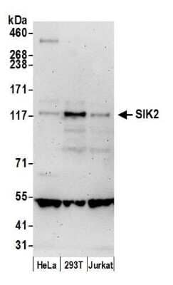 Western Blot: SNF1LK2/SIK2 Antibody [NBP1-42690] - Detection of human SIK2 by western blot. Samples:Whole cell lysate (50 ug) from HeLa, HEK293T, and Jurkat cells prepared using NETN lysis buffer. Antibody: Affinity purified rabbit anti-SIK2 antibody NBP1-42690 used for WB at 0.1 ug/ml. Detection:Chemiluminescence with an exposure time of 3 minutes.